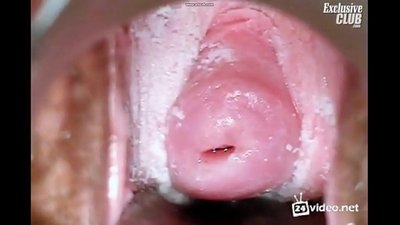 Nyocha gynecology nke nwanyị mara mma